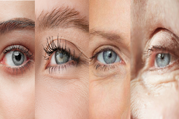 Pálpebras flácidas? Saiba quando tratar! Pálpebras flácidas? Saiba quando tratar!