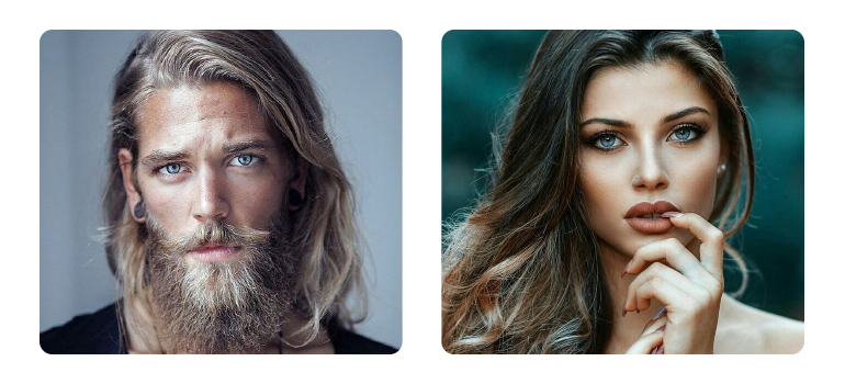 Transplante capilar em Mato Grosso.   Porque fazer aqui?       