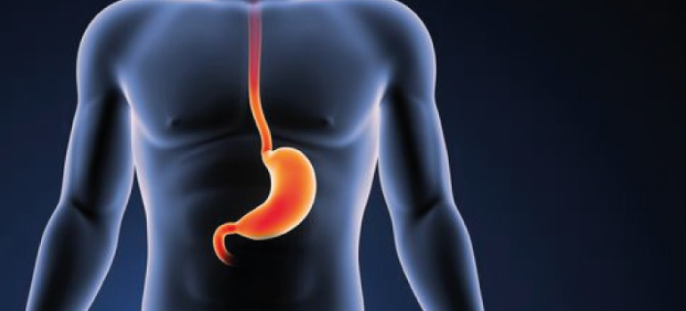 Doença do refluxo gastroesofágico