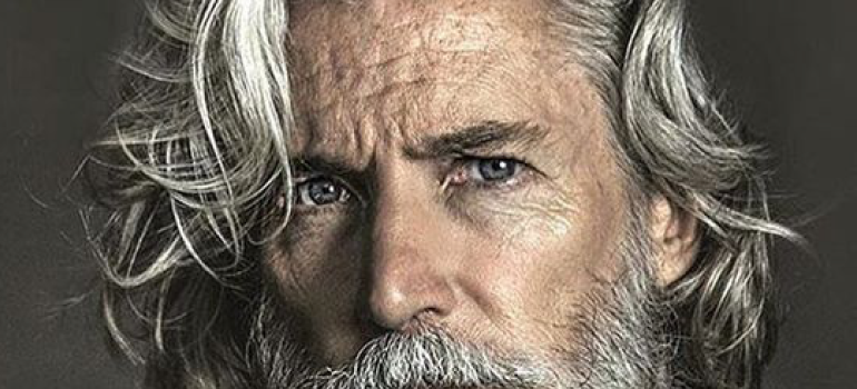 Transplante capilar em Mato Grosso. Por que fazer aqui?