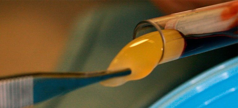 Uso de Fibrina Leucoplaquetária Autóloga na Odontologia