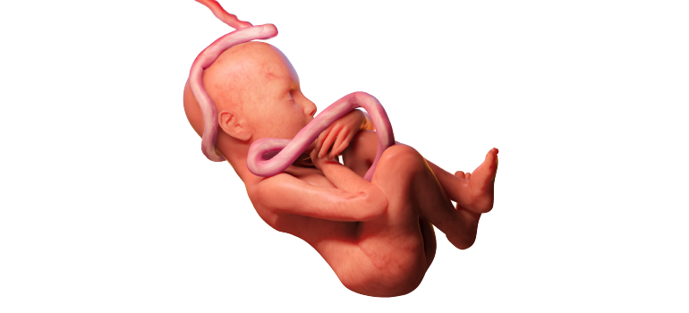 FETALCARE- RUMO À EXCELÊNCIA FETALCARE- RUMO À EXCELÊNCIA