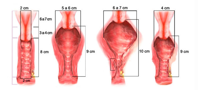 Como a fisioterapia pode melhorar a sexualidade feminina