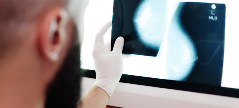  INTEGRAÇÃO ENTRE OS MÉTODOS DE DIAGNÓSTICO POR IMAGEM DAS MAMAS