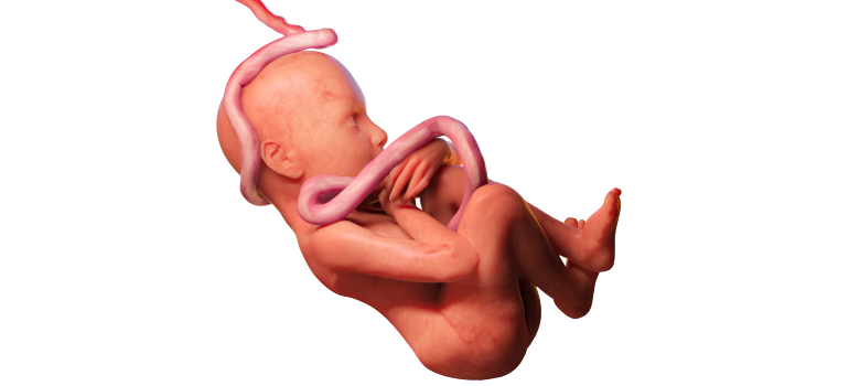 FETALCARE- RUMO À EXCELÊNCIA